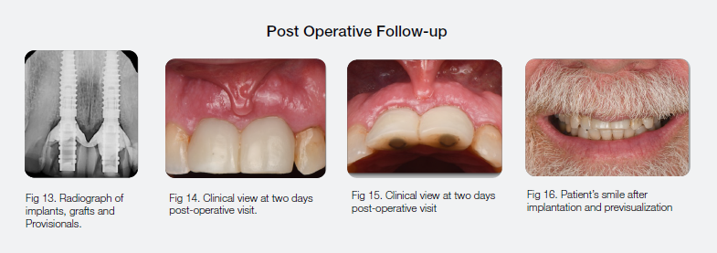 Post Operative Follow-Up